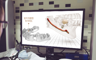 컴퓨터로 수술 계획 수립